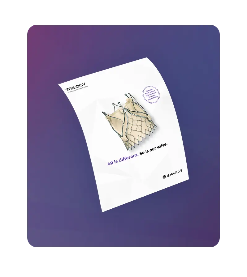 Trilogy System illustration