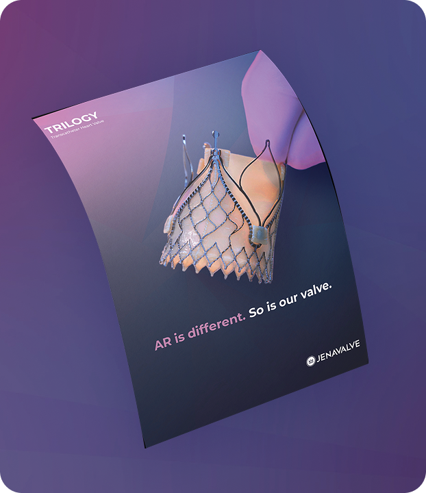 Trilogy System illustration