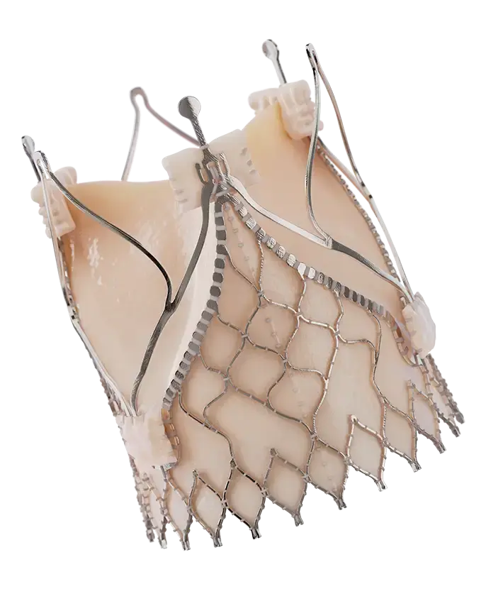 Trilogy transcatheter heart valve