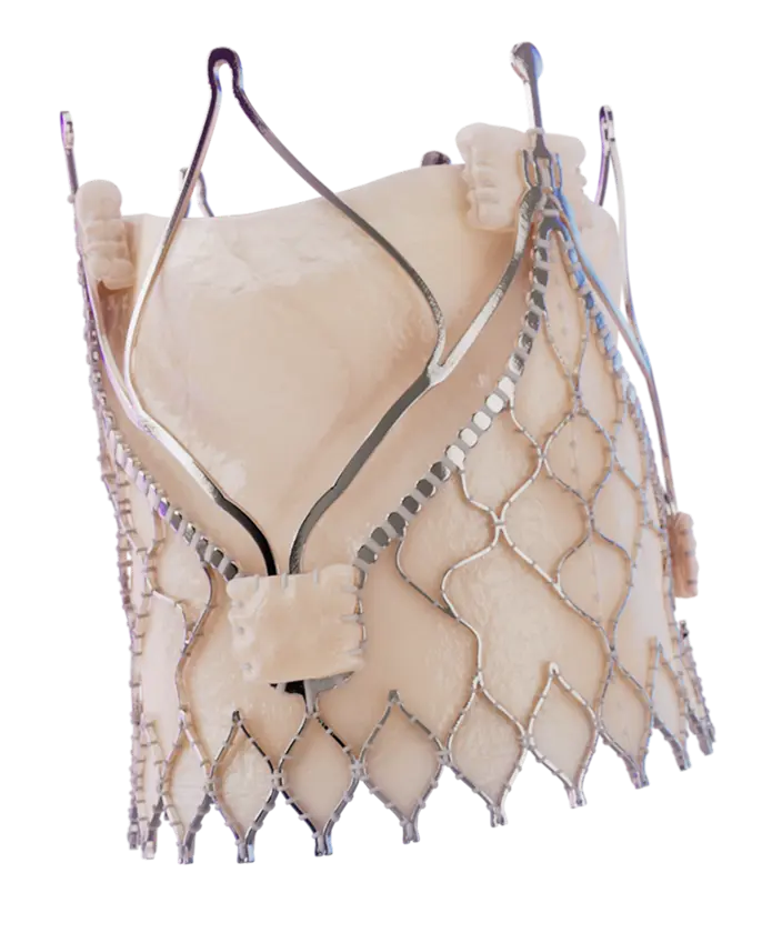 Trilogy transcatheter heart valve