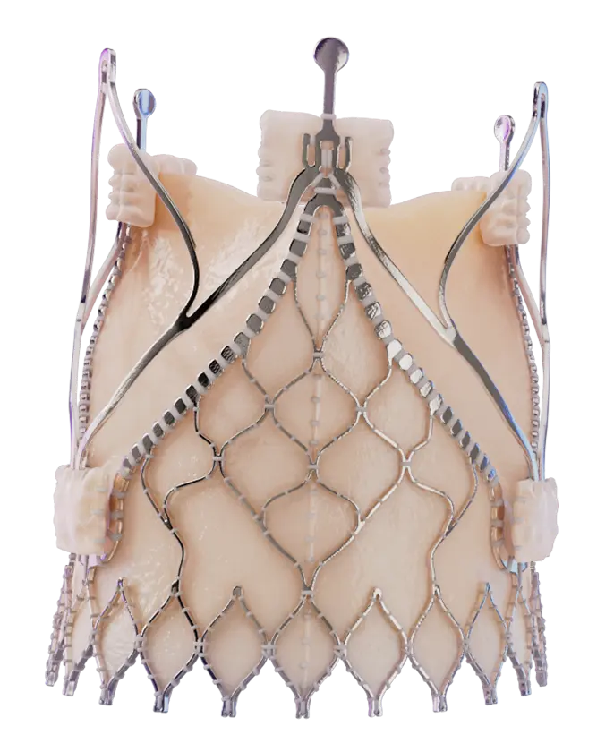 Trilogy transcatheter heart valve