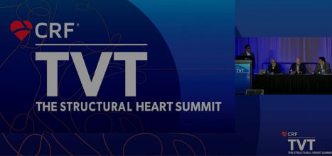 Aortic Regurgitation in 2022